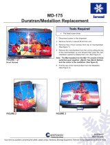 ServendMD-175 Medallion Replacement (IN-SV04-03)