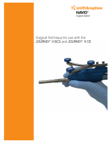 Smith & Nephew JOURNEY II CR User manual