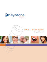 Keystone DentalStage-1