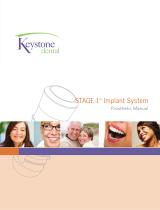 Keystone Dental Stage-1 Prosthetic Manual