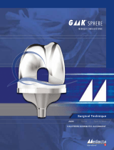 Medacta GMK Sphere Surgical Technique